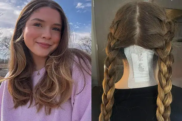 Jovem ignora tontura por anos até descobrir lesão na medula espinhal