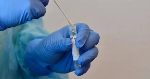 Influenza A, H1N1 e rinovírus circulam no Acre e elevam alerta para doenças respiratórias