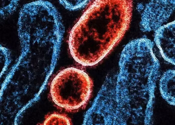 Foto: Universal Images Group/Getty Images