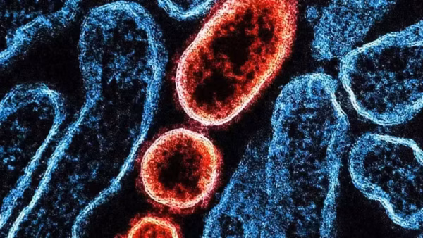 Surto de Nipah no Carnaval? Entenda se há risco para o Brasil e quais os sintomas da doença