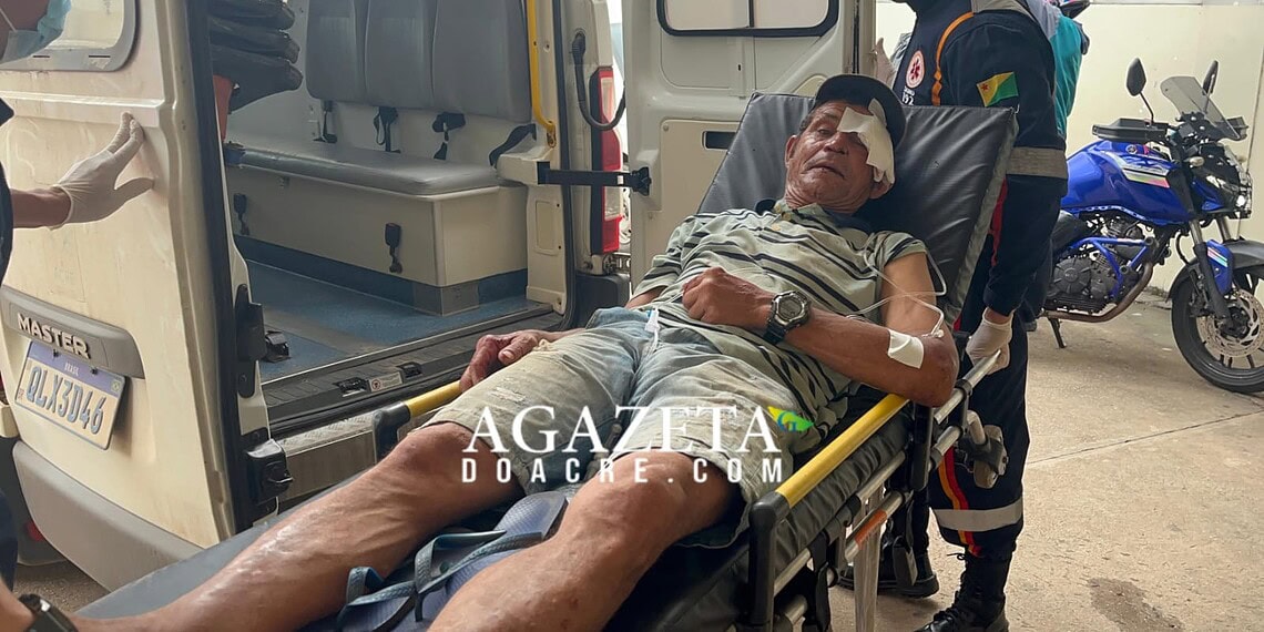 Homem de 56 anos sofre traumatismo craniano após ser atropelado no Recanto dos Buritis