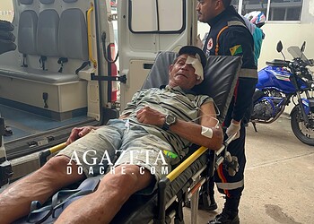 Homem de 56 anos sofre traumatismo craniano após ser atropelado no Recanto dos Buritis 4 Homem de 56 anos sofre traumatismo craniano após ser atropelado no Recanto dos Buritis
