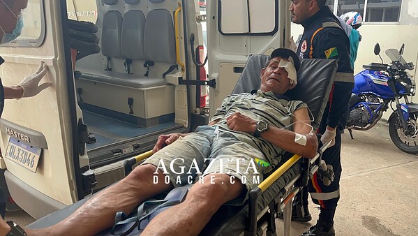 Homem de 56 anos sofre traumatismo craniano após ser atropelado no Recanto dos Buritis