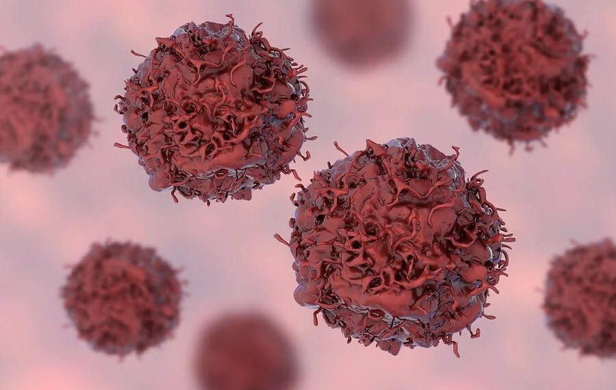 Oncologistas alertam para 7 hábitos que aumentam o risco de câncer 1 Oncologistas alertam para 7 hábitos que aumentam o risco de câncer