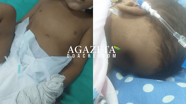 Mãe denuncia falta de material para curativos em criança que teve pé amputado em hospital de Rio Branco