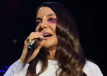 Ivete Sangalo se apresentou em São Paulo com hematoma no rosto e decidiu fazer uma cirurgia na região neste domingo
