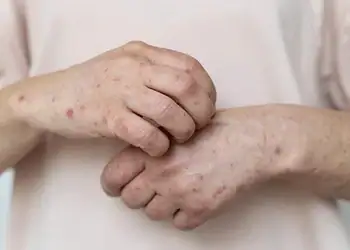 Foto:  Reprodução/ Freepik