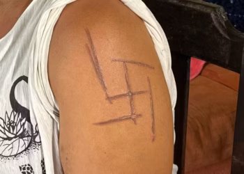 Vítima teve o símbolo nazista marcado com faca quente, em Mato Grosso do Sul — Foto: TV Morena