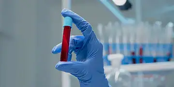 Estudo brasileiro cria exame de sangue para detectar câncer de mama