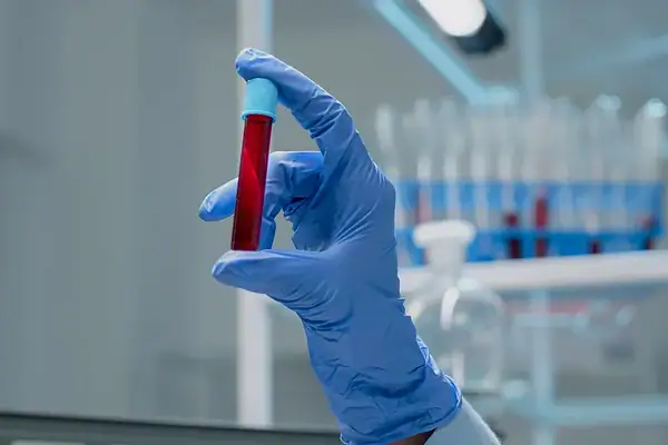 Estudo brasileiro cria exame de sangue para detectar câncer de mama