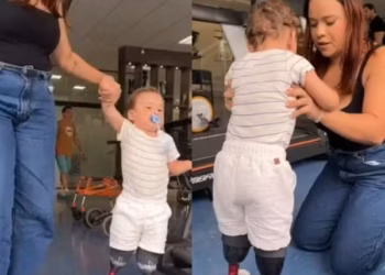 Após amputações e desvio de doações pelo pai, criança de AL ganha próteses e começa a caminhar — Foto: Reprodução/Vídeo