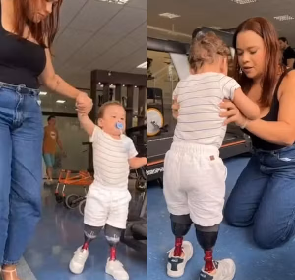 Após amputações e desvio de doações pelo pai, criança de AL ganha próteses e começa a caminhar — Foto: Reprodução/Vídeo